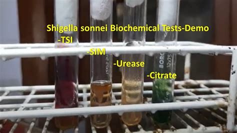 shigella sonnei biochemical tests|Historical, current, and emerging tools for identification and .
